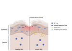 γδ T cell-mediated Wound Healing is Diminished by Allergic Skin Inflammation